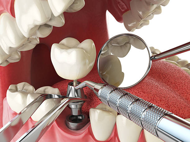 Best Cracked Tooth Emergency Dentist  in Avon Park, FL